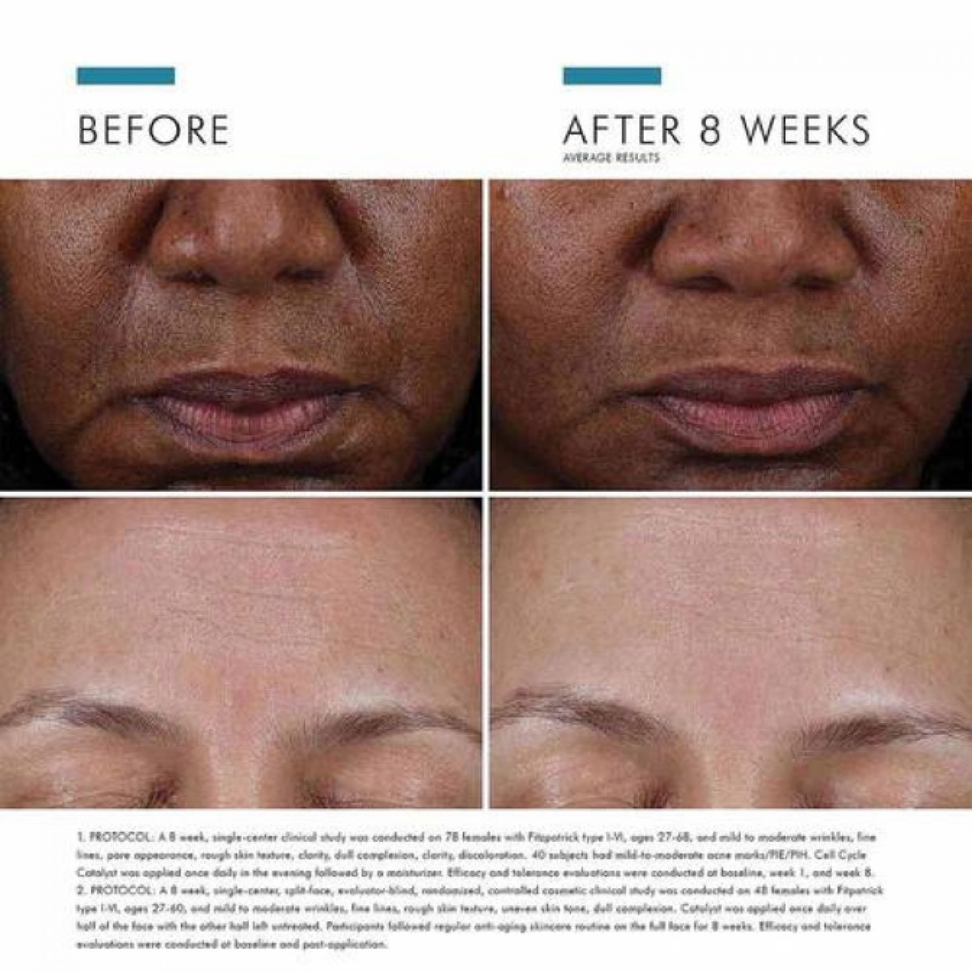 SkinCeuticals Cell Cycle Catalyst 30ml