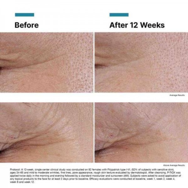 SkinCeuticals P-TIOX Sérum 30ml SkinCeuticals P-TIOX Sérum 30ml