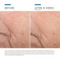SkinCeuticals Triple Lipid Restore 2:4:2 Crème Visage 48ml SkinCeuticals Triple Lipid Restore 2:4:2 Crème Visage 48ml