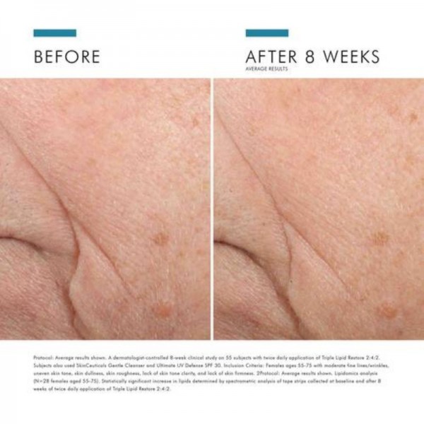 SkinCeuticals Triple Lipid Restore 2:4:2 Crema Facial 48ml SkinCeuticals Triple Lipid Restore 2:4:2 Crema Facial 48ml
