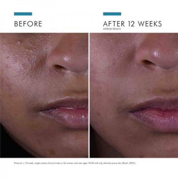 SkinCeuticals Silymarin CF 30ml SkinCeuticals Silymarin CF 30ml
