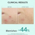 Apivita Just Bee Clear Anti-Blemish Serum 30ml Apivita Just Bee Clear Anti-Blemish Serum 30ml
