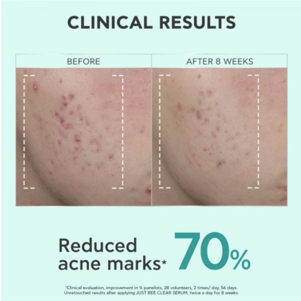 Apivita Just Bee Clear Anti-Blemish Serum 30ml Apivita Just Bee Clear Anti-Blemish Serum 30ml