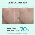 Apivita Just Bee Clear Anti-Blemish Serum 30ml Apivita Just Bee Clear Anti-Blemish Serum 30ml